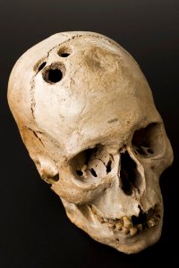 L0058402 Bronze Age skull from Jericho, Palestine, 2200-2000